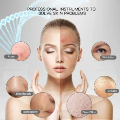 Mmgoqqt Skin Scrubbermit 4 Modi, Hautspatel, Hautpflege-Tool, Porenreiniger, Gesichtswaschspatel, Hautreiniger Für Die Tiefenreinigung Des Gesichts -Garten- & Gewächshäuser Geschäft d03474cba5217b32d68fd326e1d21a5b